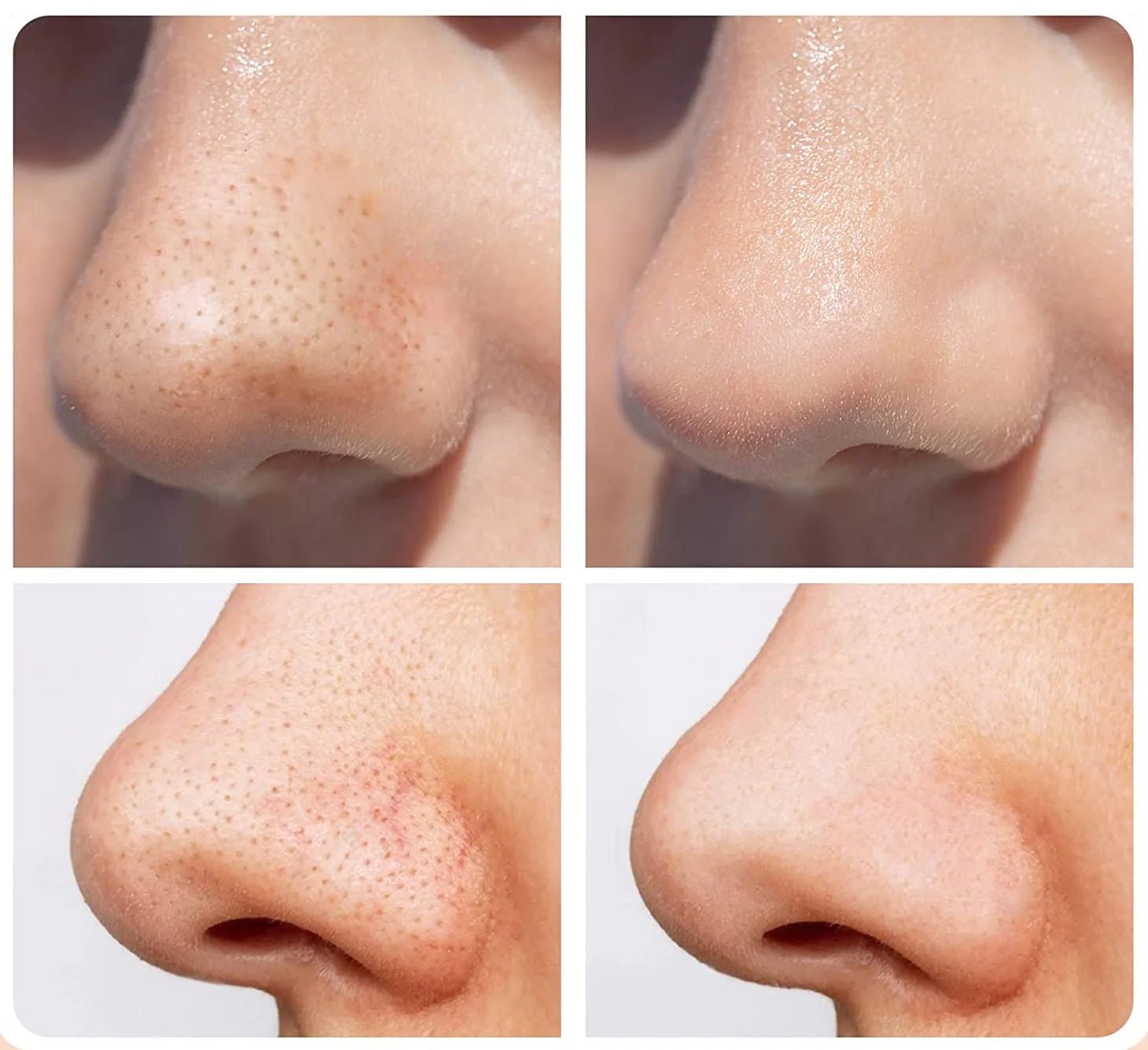 Derm Diamantsliper - AVABeauty.no